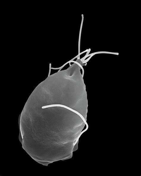 Giardia Lamblia 1 Photograph By Dennis Kunkel Microscopy Science Photo
