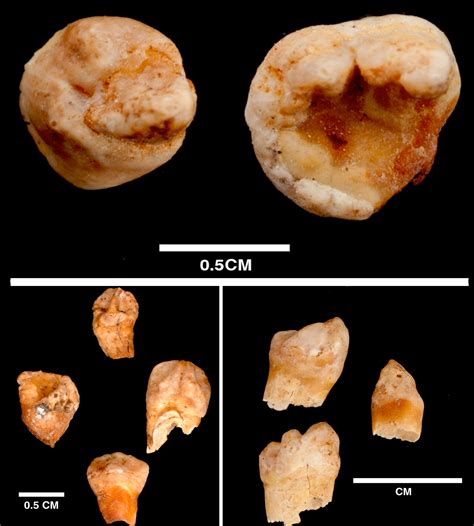 500 Year Old Teratoma Found In Peru Skeleton The History Blog
