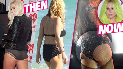 Did Kesha Get Butt Implants See Before And After Photos