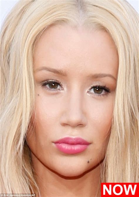 Iggy Azalea Before And After Photos Show Plastic Surgery Transformation Daily Mail Online