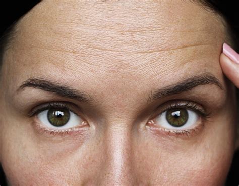 The Best Anti Aging Ingredients For Diminishing Forehead Wrinkles