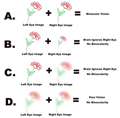 Binocular Vision Vista Eye Care Thornton Colorado Eye Doctors