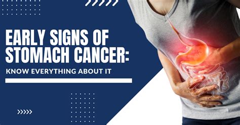 What Is The First Sign Of Stomach Cancer Archives Universitycancercenters