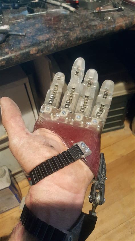 Partial Hand Prosthetic That I Designed Robotic Arm Diy Robotic