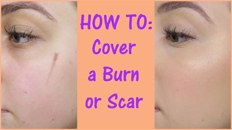 How To Cover A Scar With Makeup Youtube