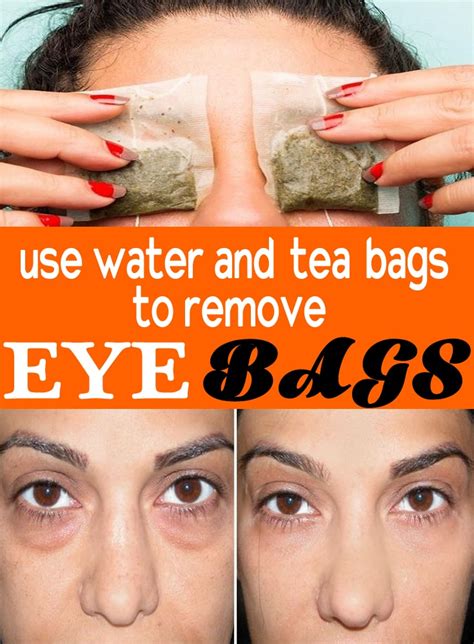How To Get Rid Of Bags Under Eyes Fast Best Home Remedies