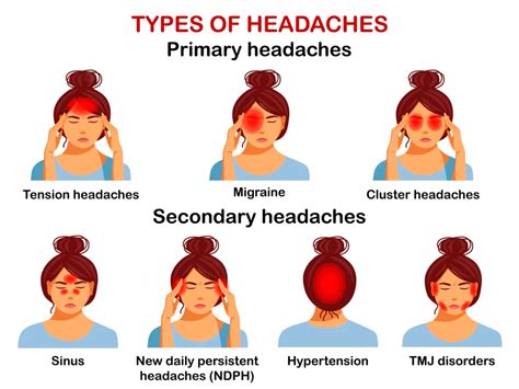 Headaches A Short Guide From Emed