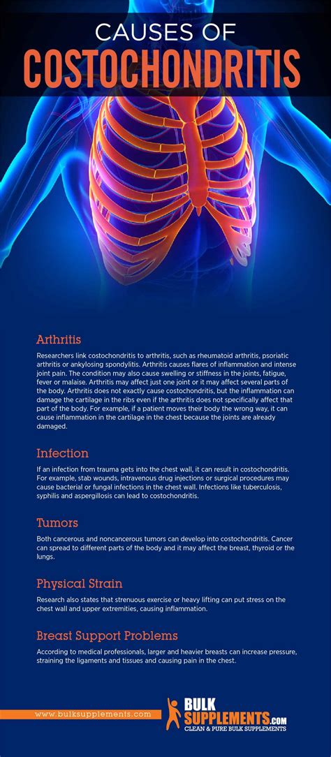 Tablo Read Costochondritis Causes Symptoms And Treatment By