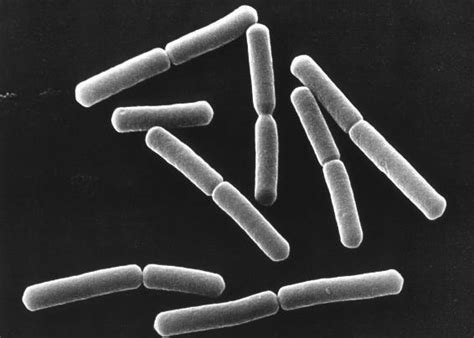 Bacillus Subtilis Dan Aplikasinya Dalam Industri ~ Blurry Eyes
