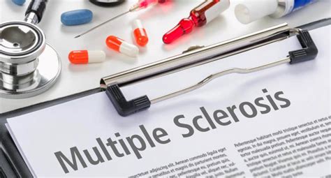 Most Promising New Multiple Sclerosis Treatment Options Howdywellness
