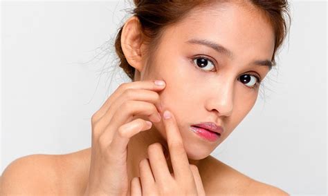 Beberapa cara bisa dilakukan untuk mengatasi kulit wajah yang mengelupas. Faktor - Faktor Penyebab Kulit Wajah Mengelupas - CANDOMBE