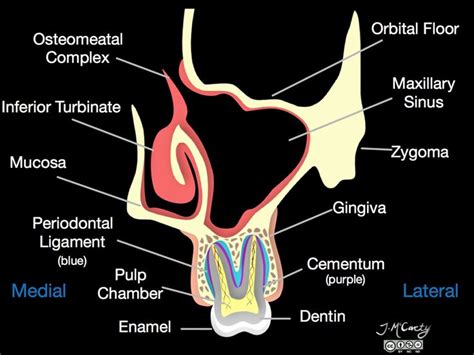 Viewing playlist: a-maypin | Radiopaedia.org | Maxillary sinus