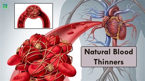How To Thin Your Blood Naturally And Prevent Blood Clots Home
