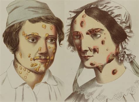 How do people get syphilis? Czy chciałbyś zachorować na syfilis? Oni o tym marzyli… i ...