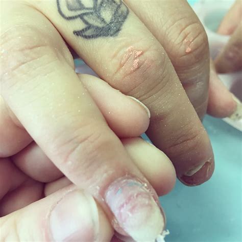 See more ideas about gel nails, nail designs, cute acrylic nails. MMA Acrylic - The North American wide Nail Salon scam you ...