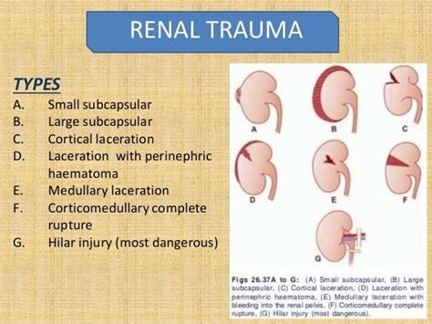 Can You Bruise Your Kidney