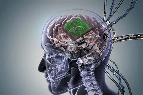 Next Generation Of Brain Implants Include More Than A Thousand