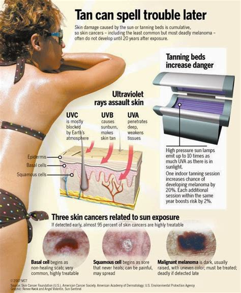 Fda Issues Warning Label For Tanning Bed Use By Minors Sponsor Of Bill For A State Ban Says He