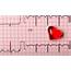 Simple Guidance For You In Home Healthcare Can An Ekg Detect A Heart 