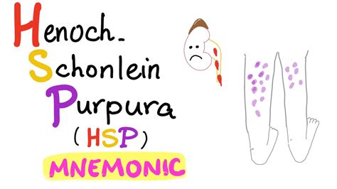 Henoch Schönlein Purpura Hsp Mnemonic ข้อมูลที่ถูกต้องที่สุด