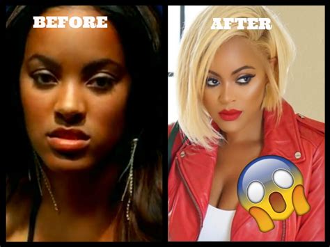 Tamar Braxton Plastic Surgery Before And After Plastic