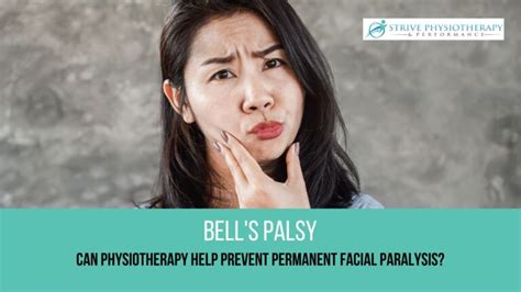 Bells Palsy Can Physiotherapy Help Prevent Facial Paralysis