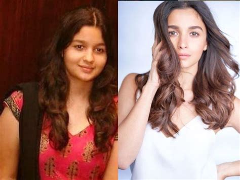 Alia Bhatt Transformation These Before After Photos Of Alia Bhatt S Drastic Transformation
