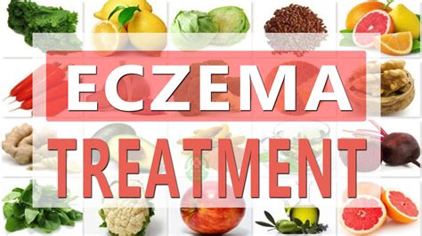 These Are The 6 Natural Remedies To Remove Eczema From Your Body Top