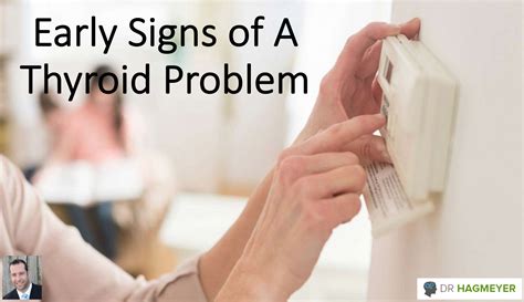 What Are The Early Signs Of Thyroid Problems Dr Hagmeyer