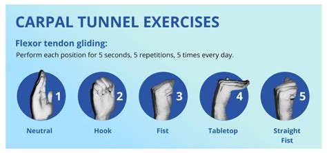 Exercises For Carpal Tunnel Pain Core Orthopedics
