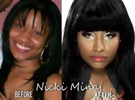 a jay blog nicki minaj before and after plastic surgery pictures