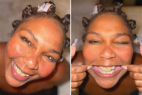 Lizzo Shows Off Freckles And Diamond Grills In New Selfies