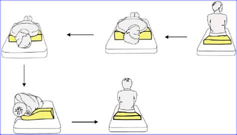 Modified Epley Maneuver For Treating Right Sided Bppv Download
