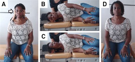 Gufonis Maneuver To Treat Hc Bppv Cupulolithiasis Patient Sits