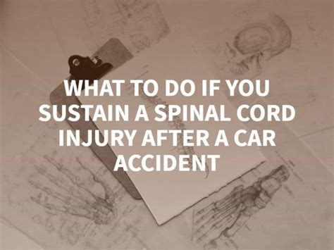 What To Do If You Sustain A Spinal Cord Injury After A Car Accident