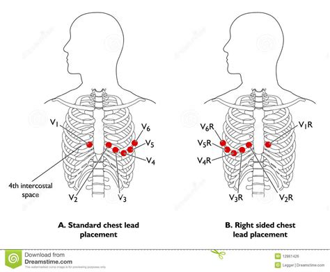 Posterior Ecg Lead Placement Ecg Introduction At University Of Texas