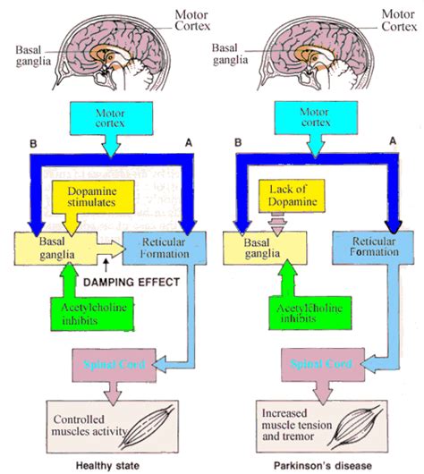 Understanding Parkinsons Disease How Our Brain Controls Our Movement