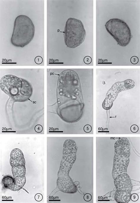 Spores And Filamentous Phase Of Blechnum Figs 1 3 Blechnum Spores