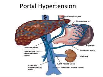 Or sometimes, they may form because of a blow to they can be caused by conditions like diverticulitis or liver disease, or even by birth control pills. Portal hypertension is an increase in pressure within a system of veins called the portal venous ...