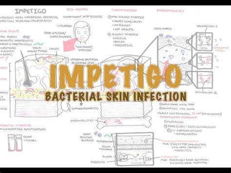 Impetigo Bacterial Skin Infection Overview Clinical Presentation