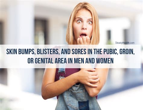 Skin Bumps Blisters And Sores In The Pubic Groin Or Genital Area In