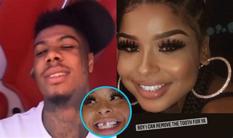 Chrisean Rock Tells Blueface Shell ‘remove Her Tooth For Him After He