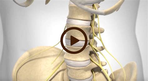 Lumbar Degenerative Disc Disease Beach Orthopedic Specialty Institute