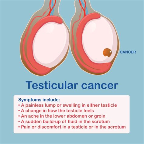 How To Know If You Have A Testicular Cancer How Do You Know If You