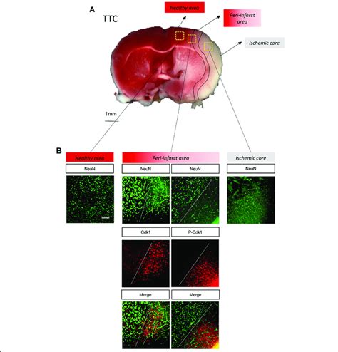 Transient Cerebral Ischemia Induces Cdk1 Expression And Activation A