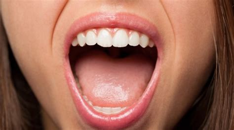 Sindrom Gorućih Usta Dentbih