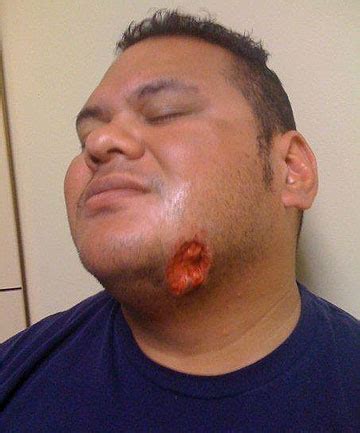 Face bite victim disappointed with appeal | Stuff.co.nz
