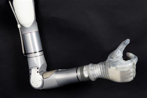 Luke The Bionic Arm Is Helping Amputees Feel Whole Again Health