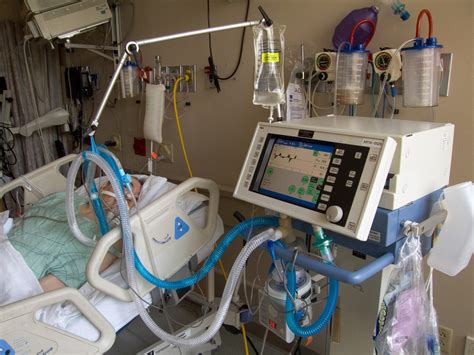 Updated Guidelines For Management Of Hospital Acquiredventilator