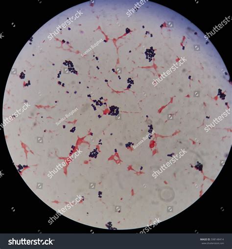 Gram Positive Cocci Bacteria Under 100x ภาพสต็อก 598148414 Shutterstock